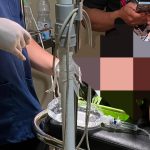 Korban pengeroyokan di Cafe Palopo, ist, hashtagnews.id