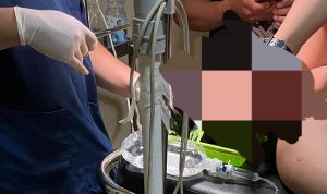 Korban pengeroyokan di Cafe Palopo, ist, hashtagnews.id